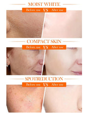 Crema facial vitamina C y niacinamida