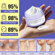 Crema cuello y escote antiedad
