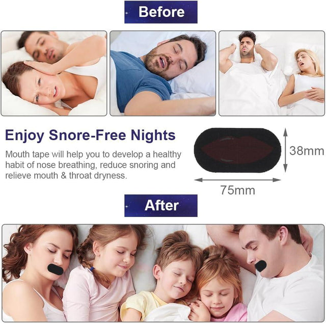 Tiras Bucales Antirronquidos para Dormir