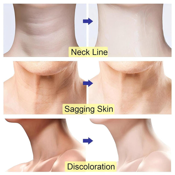 Crema cuello y escote antiedad