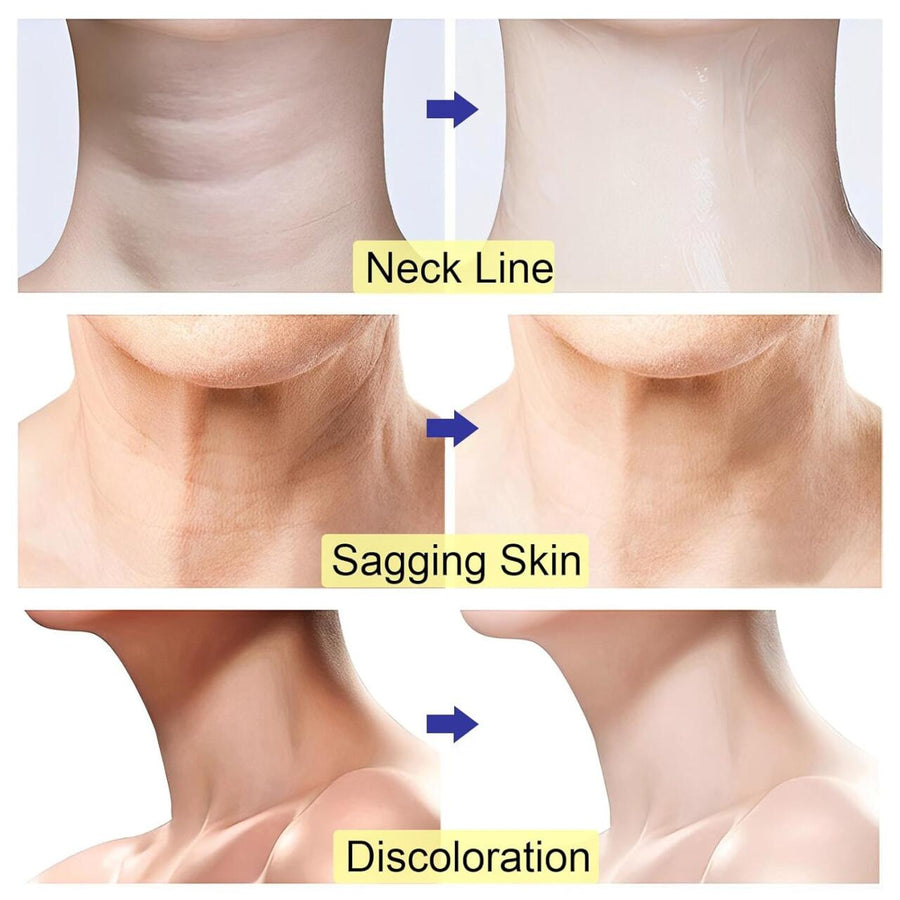 Crema cuello y escote antiedad