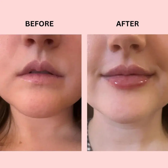 Lipboost reafirmante de labios natural