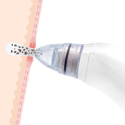 Aspirador de puntos negros facial