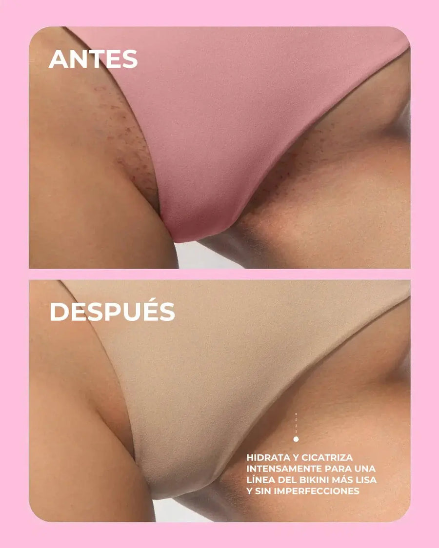 Aceite after shave para depilación | Novarso
