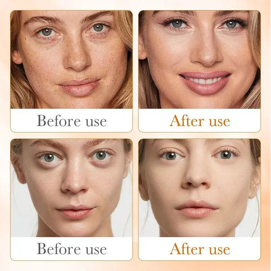 Sérum Vitamina C 100 ml para rostro