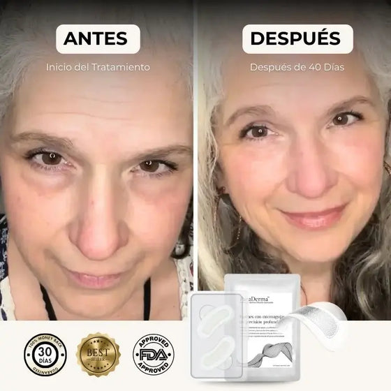 Parches antiojeras hidratantes 10 pares