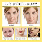 Crema Facial Caracol 92 Hidratación Profunda