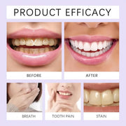 Tiras Blanqueadoras Dientes para Casa