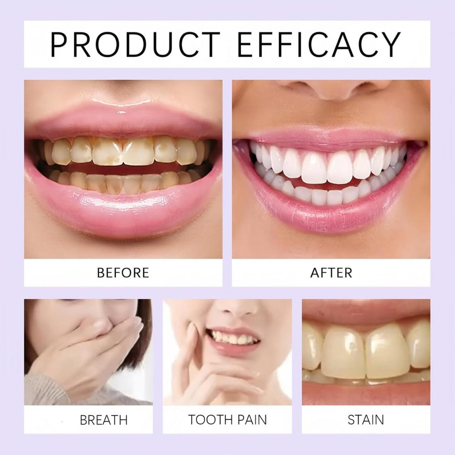Tiras Blanqueadoras Dientes para Casa