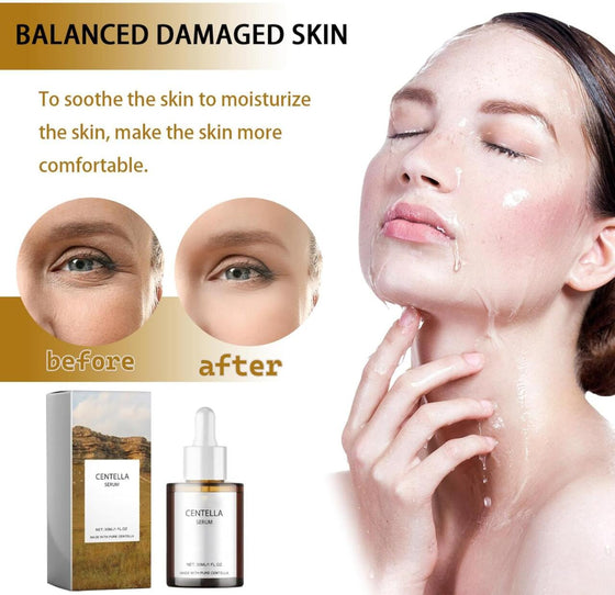 Suero Facial Centella Asiática Calmante