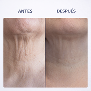 Rodillo 3D cuello y rostro antiarrugas