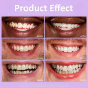 Tiras Blanqueadoras Dientes para Casa