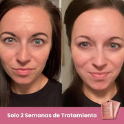 Mascarillas Biocolágeno para piel hidratada