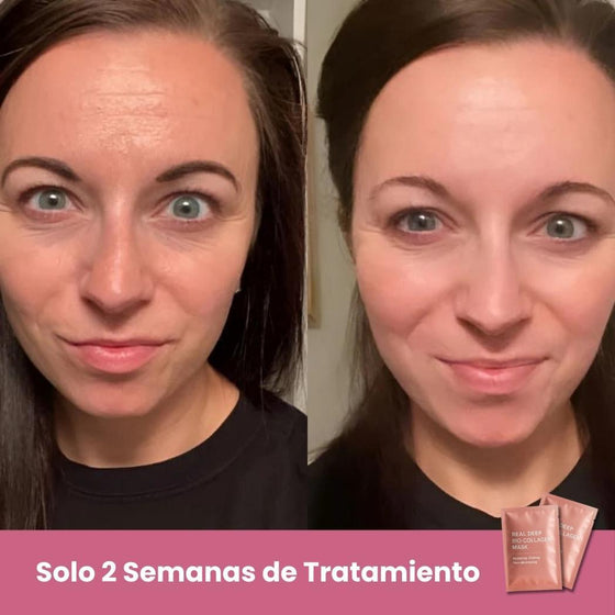 Mascarillas Biocolágeno para piel hidratada
