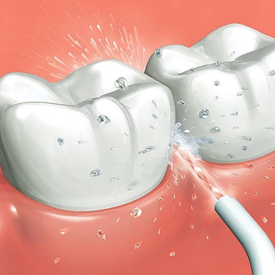 Irrigador dental inalámbrico portátil