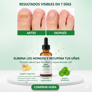 Spray antihongos uñas y pies natural