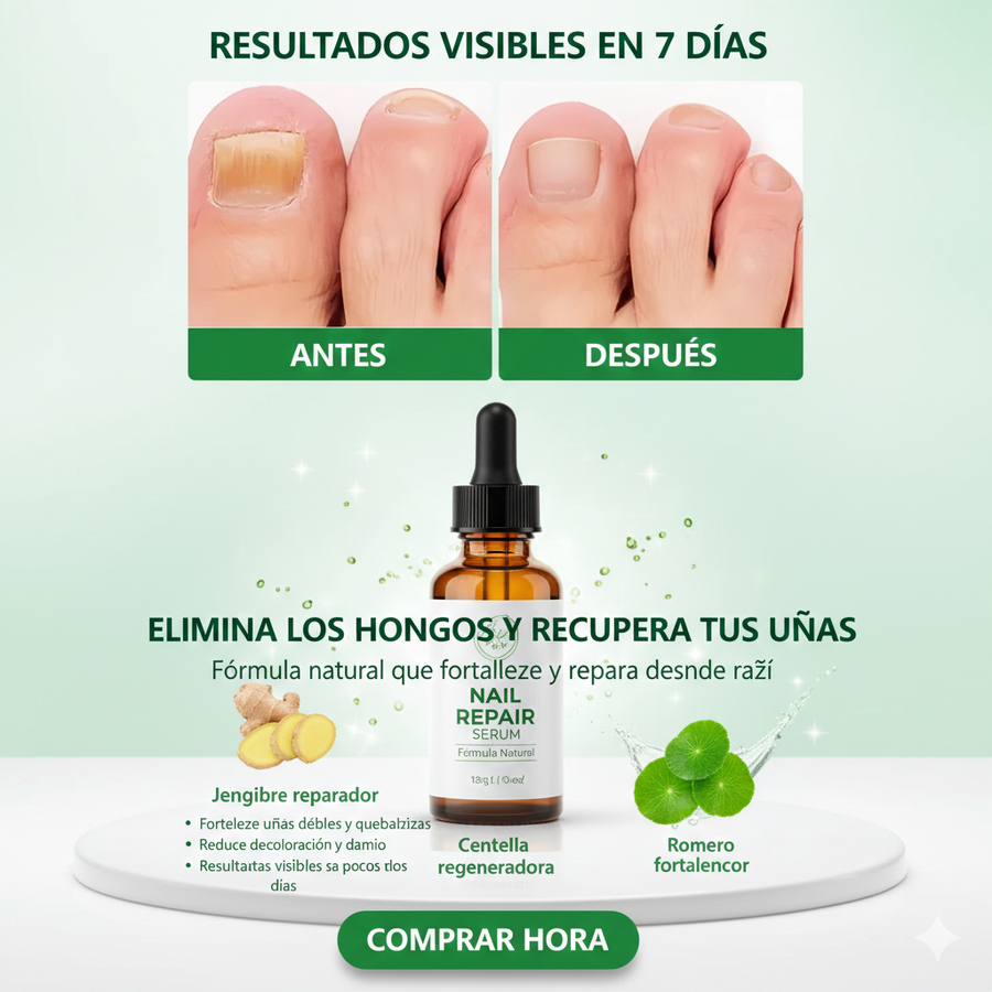 Spray antihongos uñas y pies natural