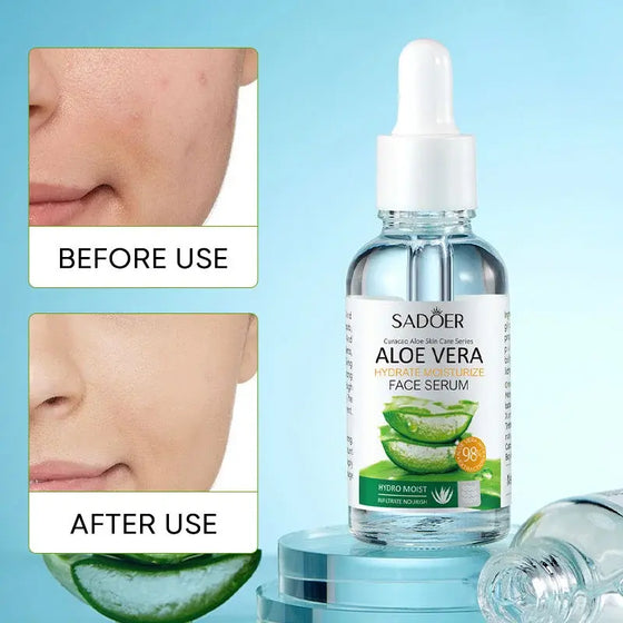 Esencia facial aloe vera hidratante natural