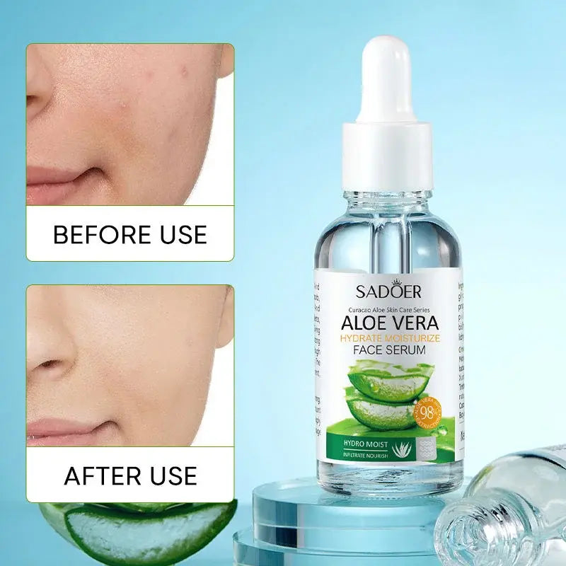 Esencia facial aloe vera hidratante natural