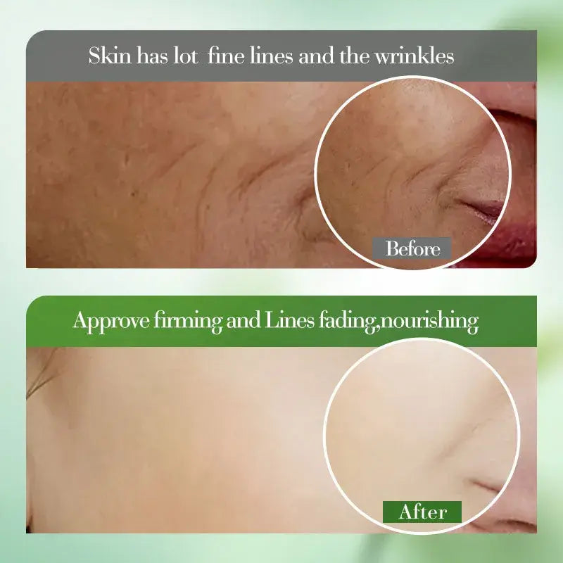 Crema Aloe Vera 99% reparadora y reafirmante