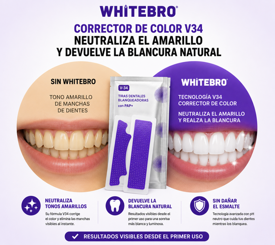 Tiras blanqueadoras dentales V34 en casa