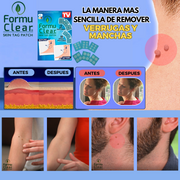 Parches para verrugas sin dolor | Novarso