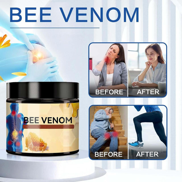Crema veneno de abeja articulaciones